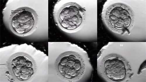 宝宝感冒鼻塞,一个多月的宝宝怎么办?